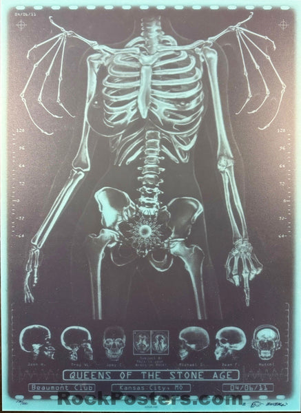 AUCTION - Queens of the Stone Age - Kansas City '11 - X-Ray Skeleton - 1st Edition - Emek - Mint