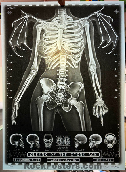 AUCTION - Queens of the Stone Age - Kansas City '11 - X-Ray Skeleton - 1st Edition - Emek - Mint