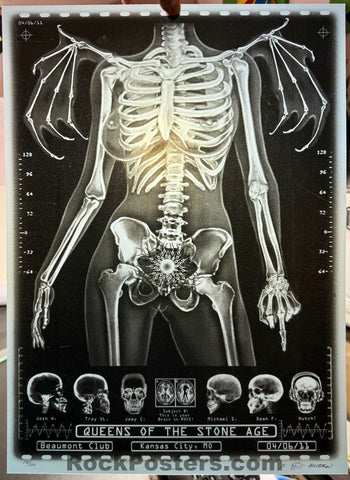 AUCTION - Queens of the Stone Age - Kansas City '11 - X-Ray Skeleton - 1st Edition - Emek - Mint