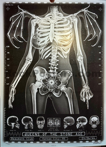AUCTION - Queens of the Stone Age - Kansas City '11 - X-Ray Skeleton - 1st Edition - Emek - Mint - SF Rock Posters & Collectibles