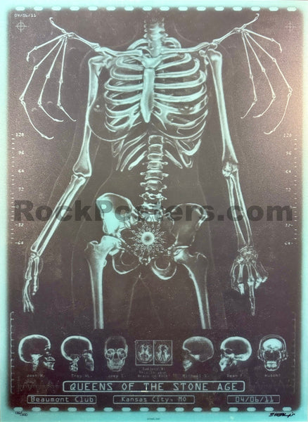 AUCTION - Queens of the Stone Age - Kansas City '11 - X-Ray Skeleton - 1st Edition - Emek - Mint - SF Rock Posters & Collectibles