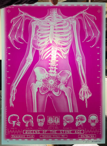 AUCTION - Emek - Queens of the Stone Age - Kansas City '11 - X-Ray Skeleton - Red Variant - Edition of 13 - Mint